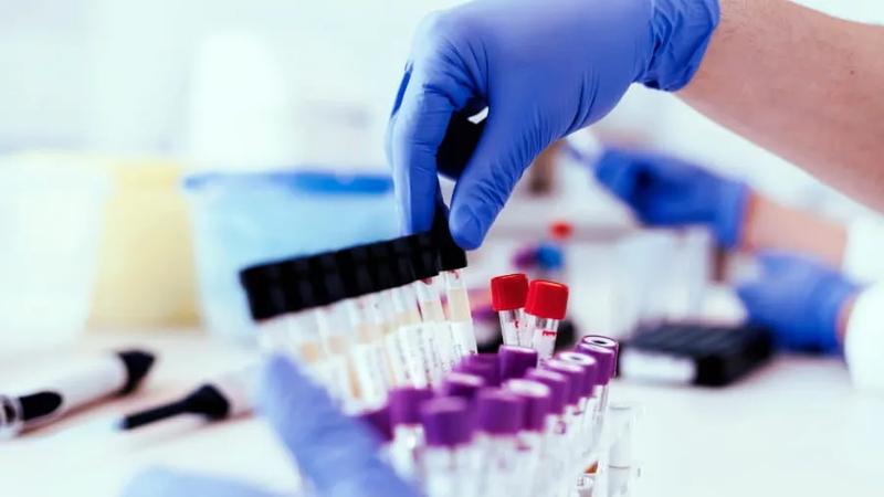 Doctor grabs test tubes