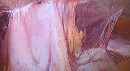OB-GYN High-Laparoscopic 1 web