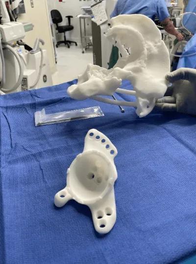  Hip Replacement surgery