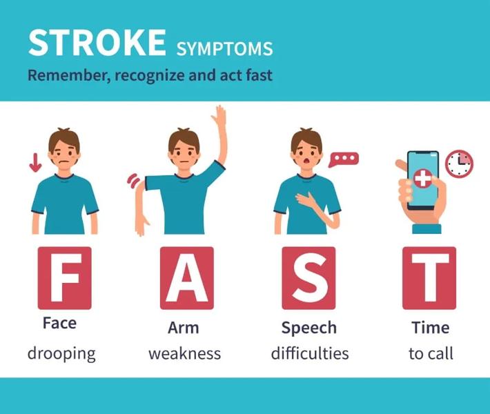 FAST acronym  Face Arm Speech Time