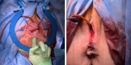 Urogynecology 2 web