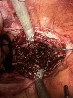 OB-GYN High-Laparoscopic 2 web