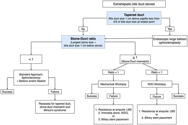 Bile Duct Stone Flow Diagram inline