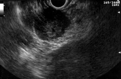 AI Endoscopic Procedures 1 web