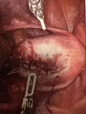 OB-GYN High-Laparoscopic 3 web