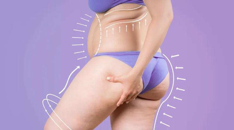 if you miss a dose of semaglutide Skip Semaglutide? How to Get Back on Track Volume:100 uL salegroupB A 76-year-old woman’s wrongful