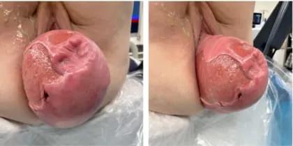 Urogynecology 1 web