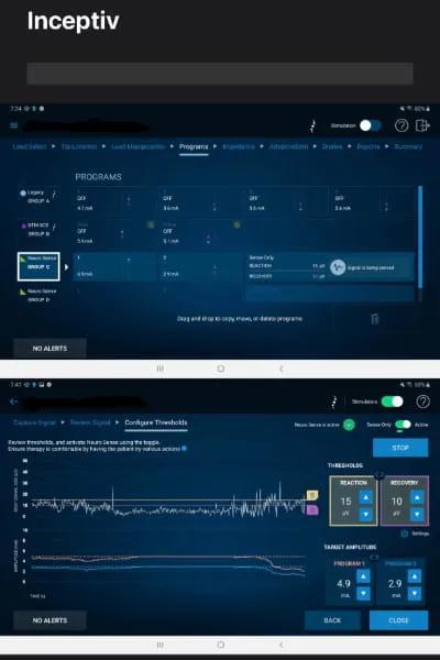 Novel Closed Loop Spinal Cord Stimulator Advances Personalized Pain Management 1