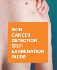 Skin cancer self-exam guide